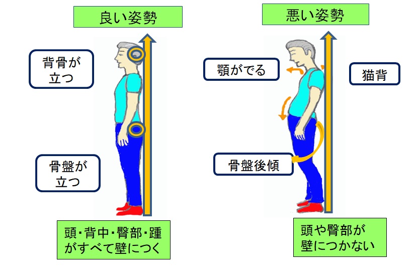 姿勢改善