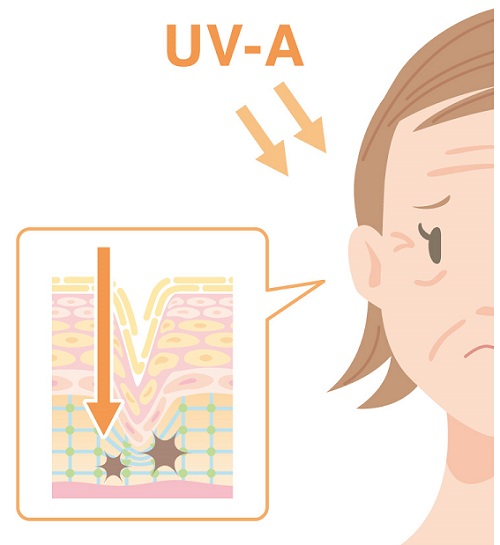 UV-A