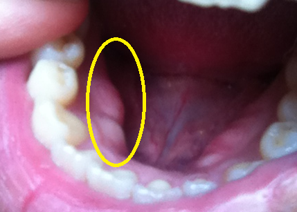 f:id:happyhappy28:20180702121604p:plain