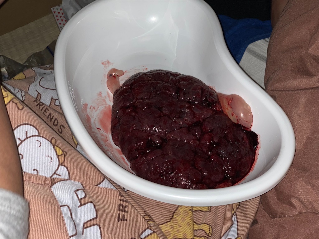 f:id:happyset8enspinner:20181221201055j:image