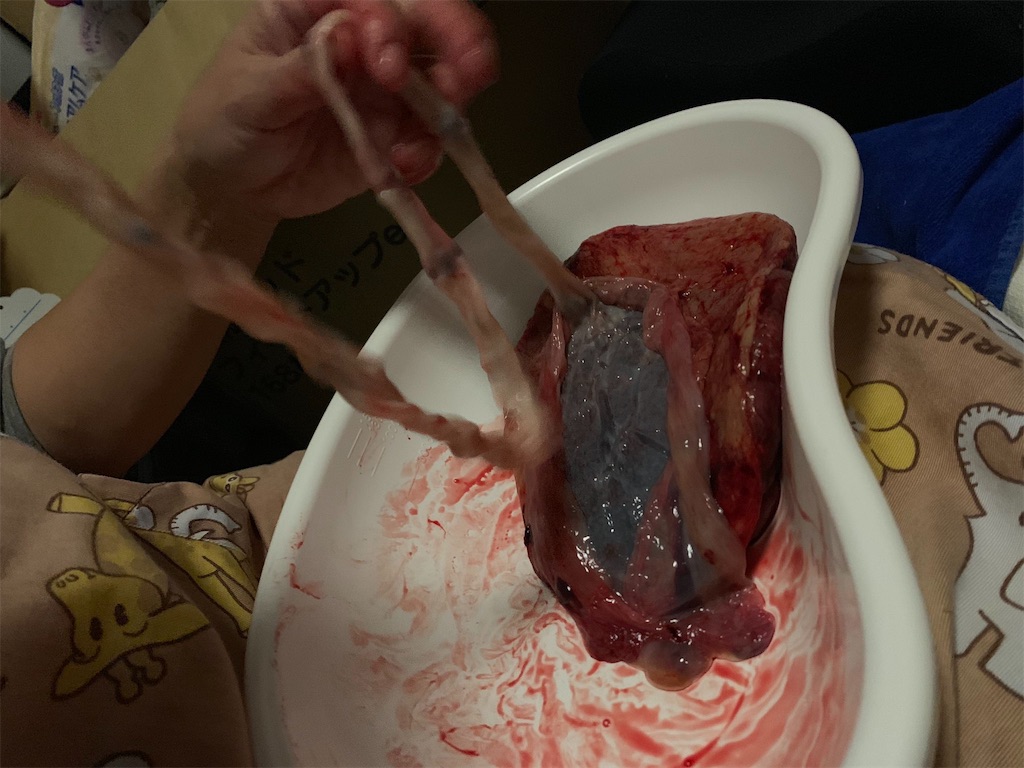 f:id:happyset8enspinner:20181221201116j:image