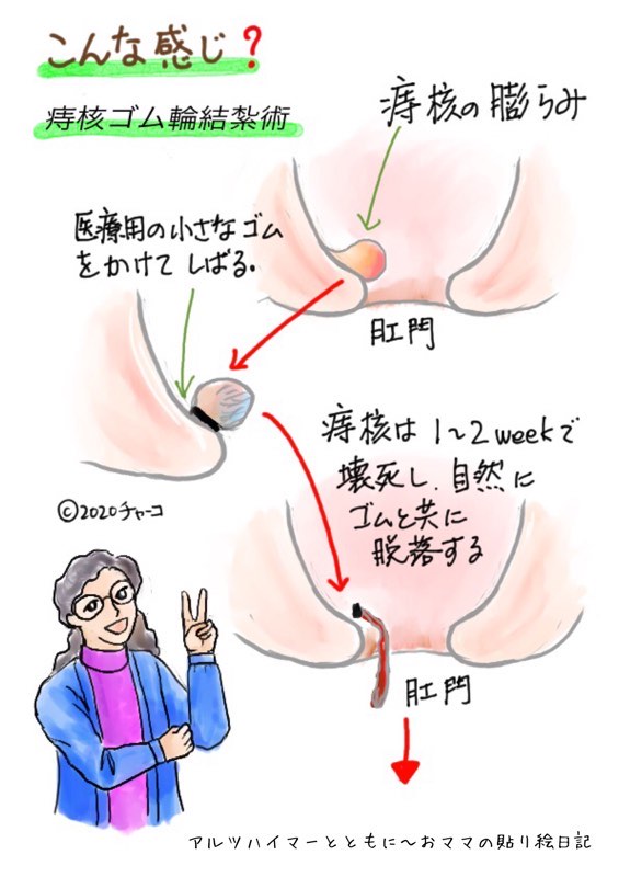 f:id:harienikki:20201107162453j:plain
