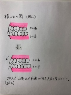 f:id:harushiro:20190918221630j:plain