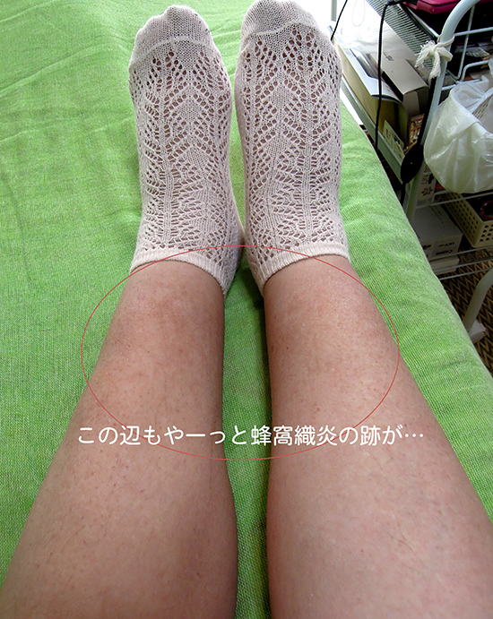 f:id:haruusagi_kyo:20200802071735j:plain f:id:haruusagi_kyo:20200802071735j:plain