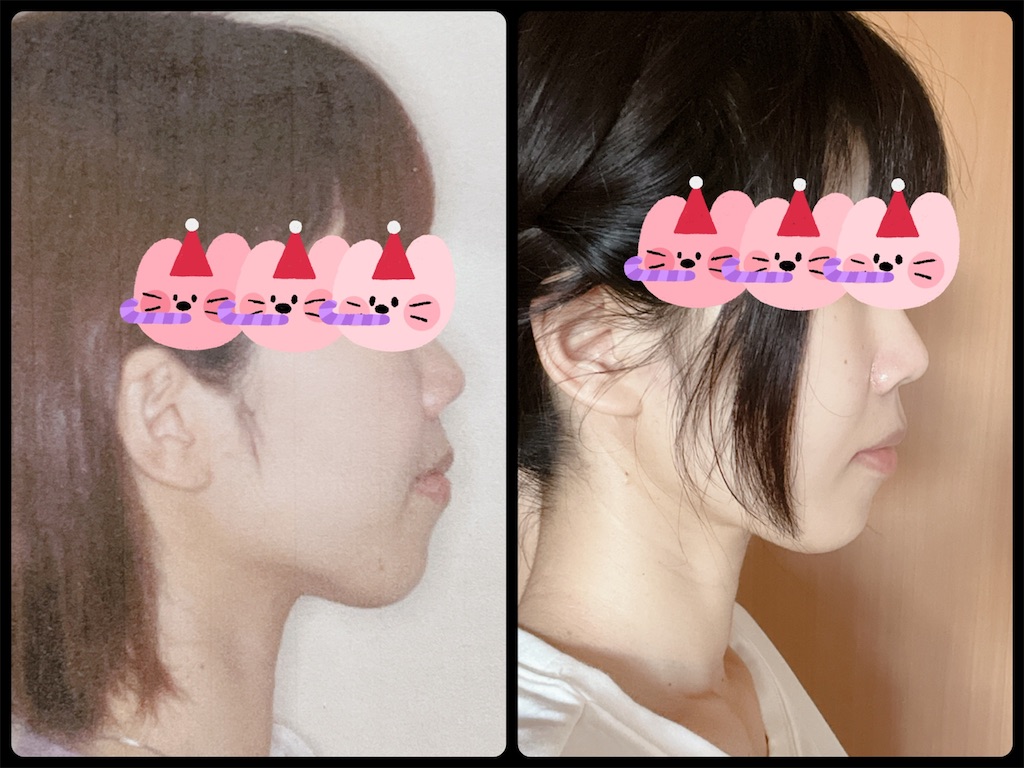 f:id:hashiro-abi:20220809124002j:image f:id:hashiro-abi:20220809124002j:image