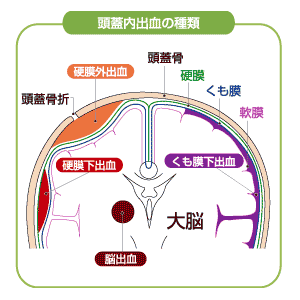 f:id:hatehei666:20120327110148g:image:left