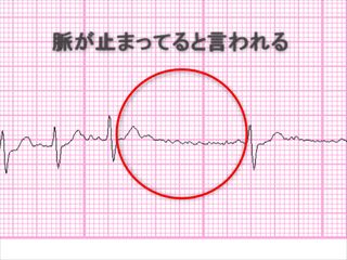 f:id:hatikinkun:20200813223421j:plain