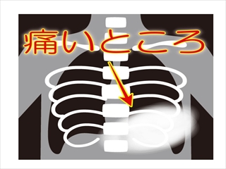 f:id:hatikinkun:20201019220417j:plain f:id:hatikinkun:20201019220417j:plain
