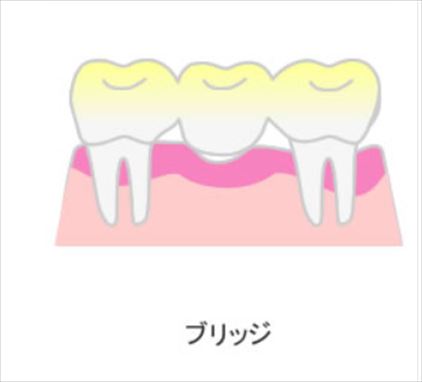 f:id:hatikinkun:20210118233327j:plain