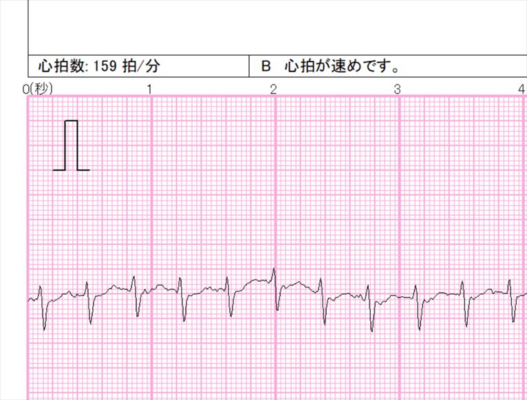 f:id:hatikinkun:20210411163006j:plain