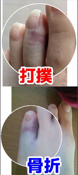 f:id:hatikinkun:20211112125015j:plain