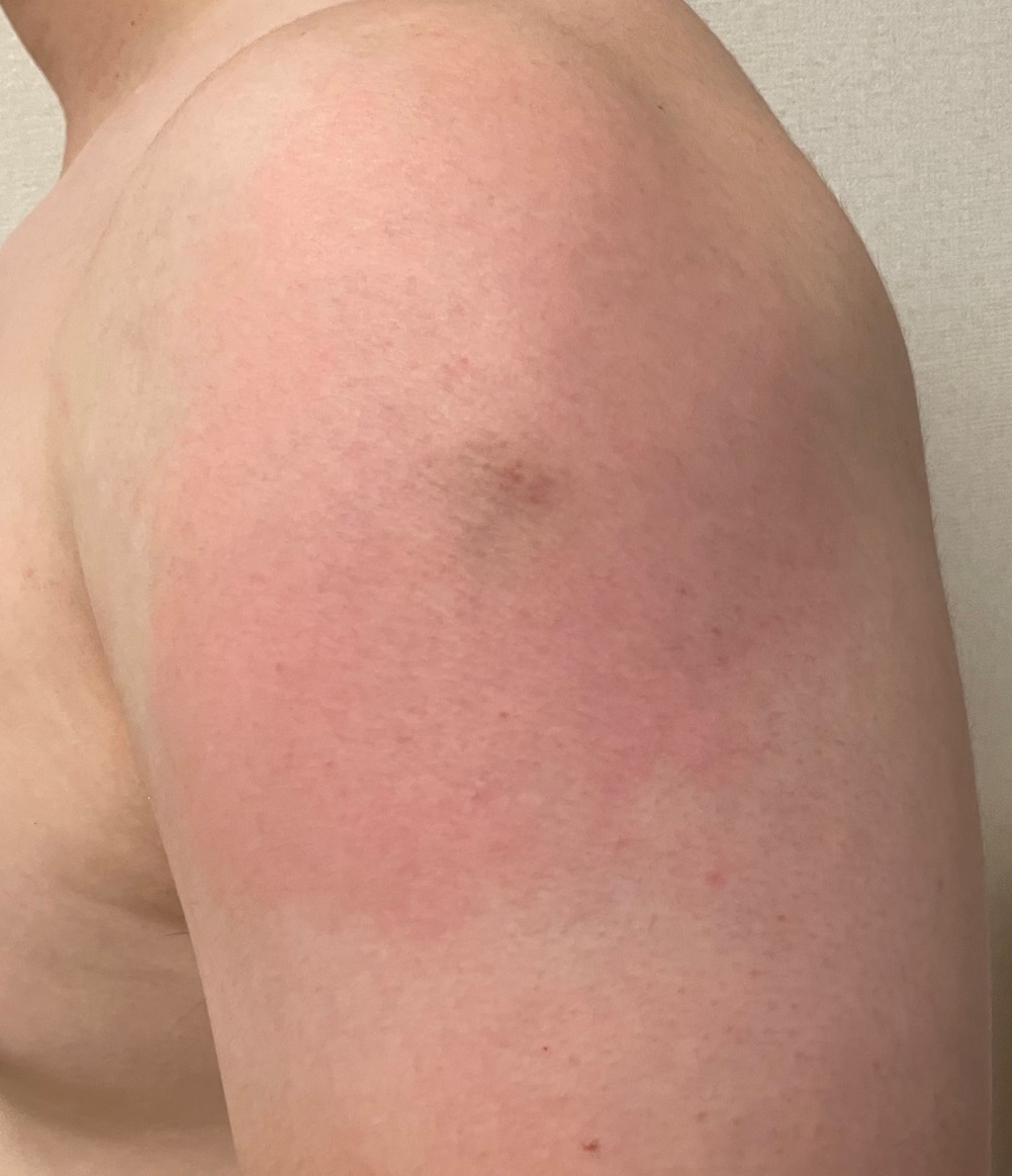 f:id:hative:20210908223303j:plain