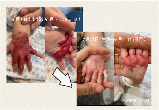 f:id:hatohato1234:20201222073927j:image