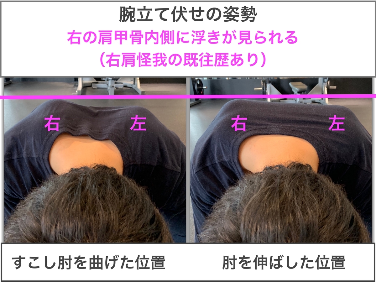 f:id:health--life:20190425190432j:plain