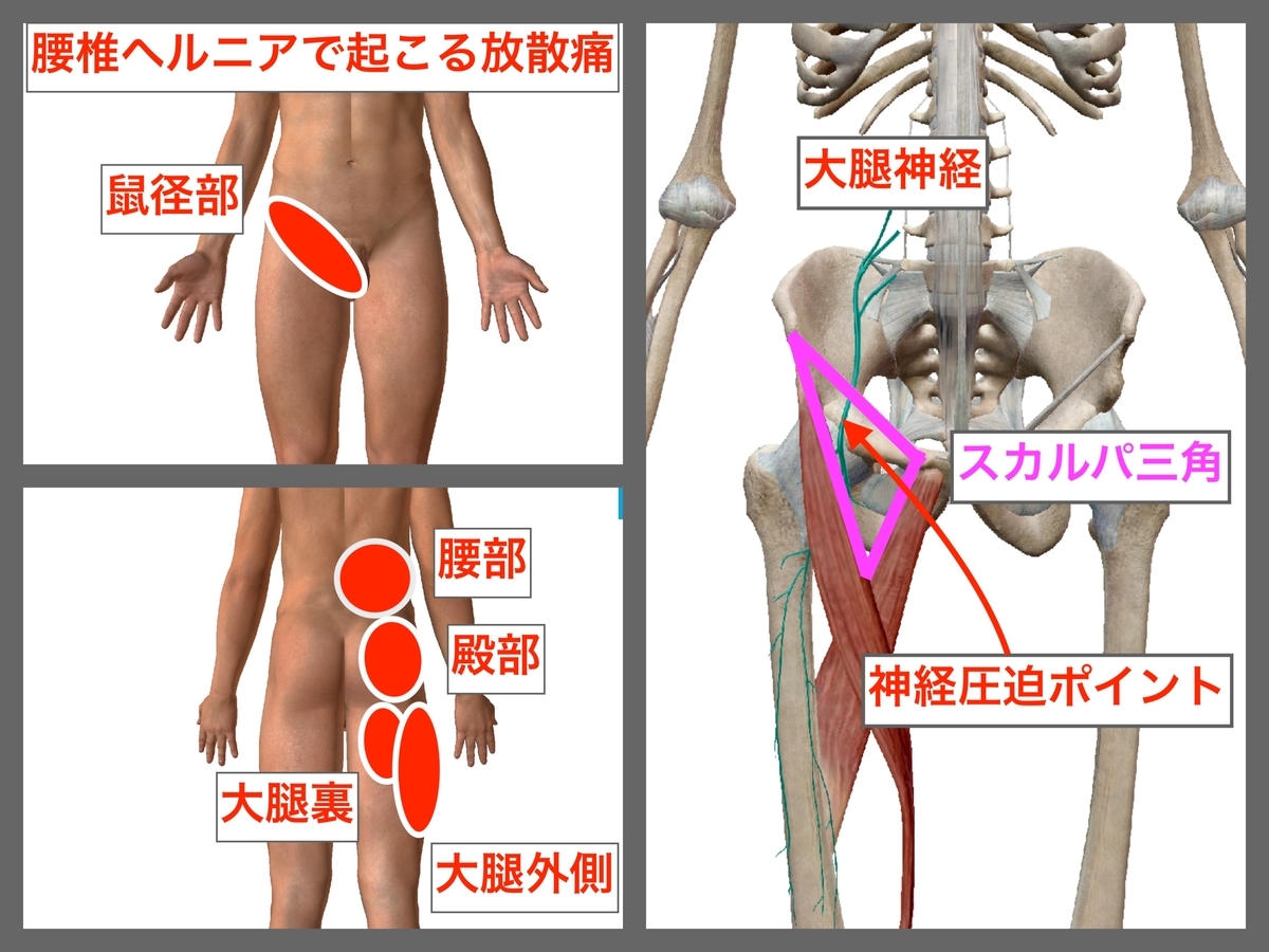 f:id:health--life:20190915132711j:plain