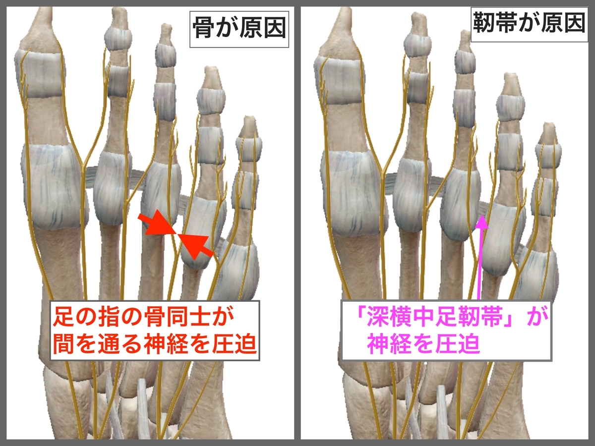 f:id:health--life:20191203130719j:plain f:id:health--life:20191203130719j:plain