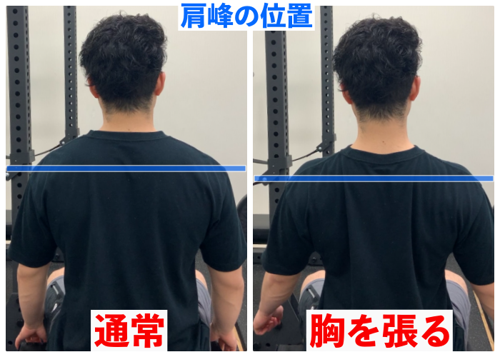 胸郭出口症候群 ベンチプレスやり過ぎ注意 首 肩 腕の痛み しびれの原因とは トレーニング強化書 胸郭出口症候群 ベンチプレスやり過ぎ注意 首 肩 腕の痛み しびれの原因とは トレーニング強化書