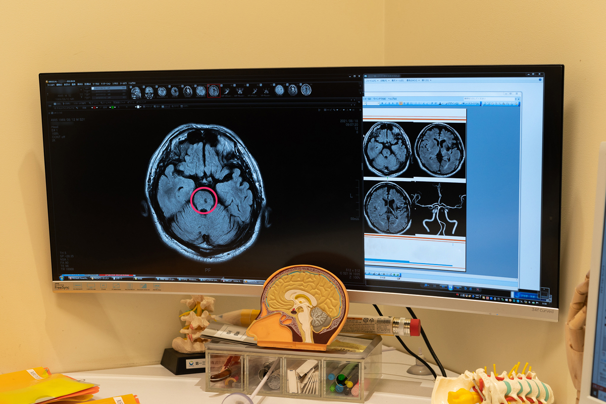 f:id:healxheel:20210831205103j:plain