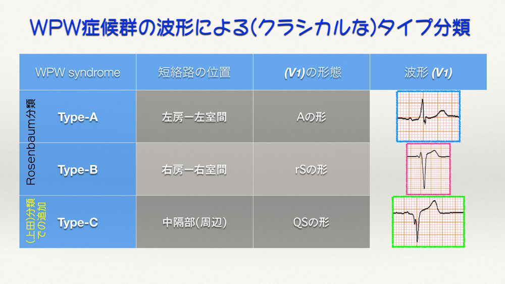 Ecg 354 Answer 2 3 心電図検定試験 傾向と対策 Q 002 Cardio12のecgブログ 19改