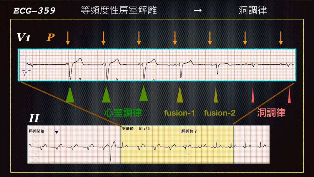 f:id:heart2019:20200115160454j:plain