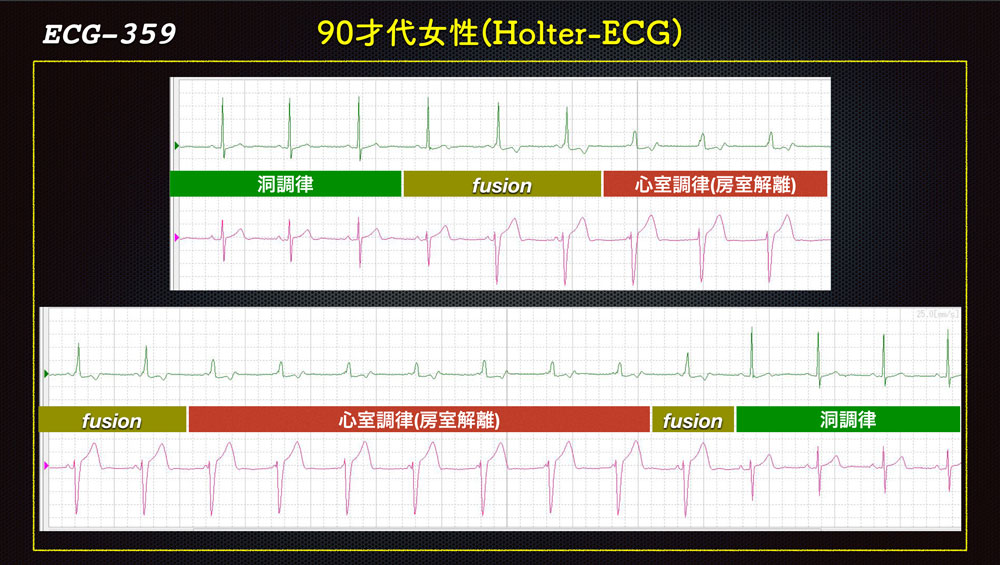 f:id:heart2019:20200115160556j:plain
