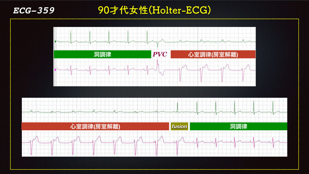 f:id:heart2019:20200115160620j:plain