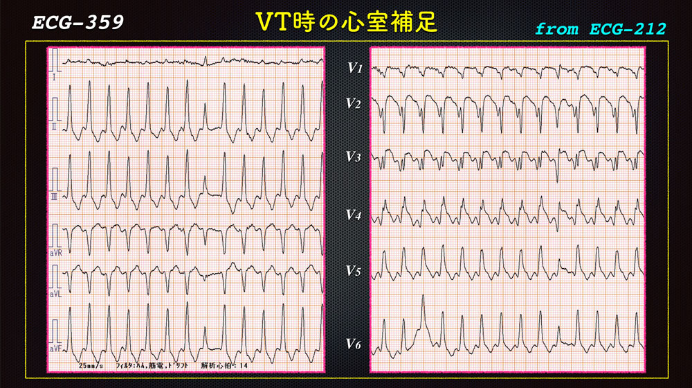 f:id:heart2019:20200118222602j:plain