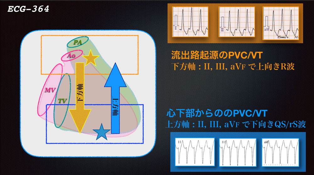 f:id:heart2019:20200217222329j:plain