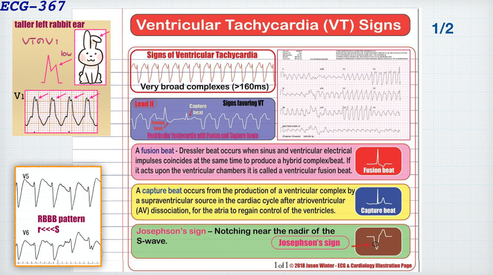 f:id:heart2019:20200311230508j:plain