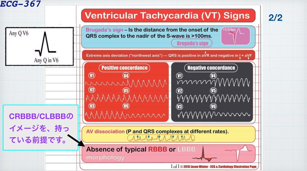 f:id:heart2019:20200311230535j:plain