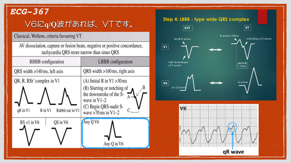 f:id:heart2019:20200311231249j:plain