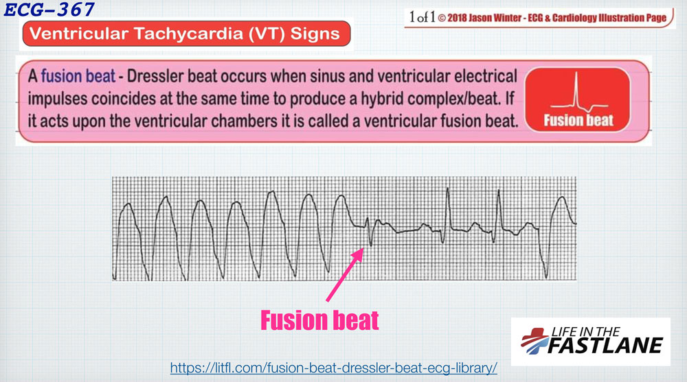 f:id:heart2019:20200311231633j:plain