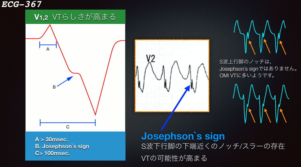 f:id:heart2019:20200311231822j:plain