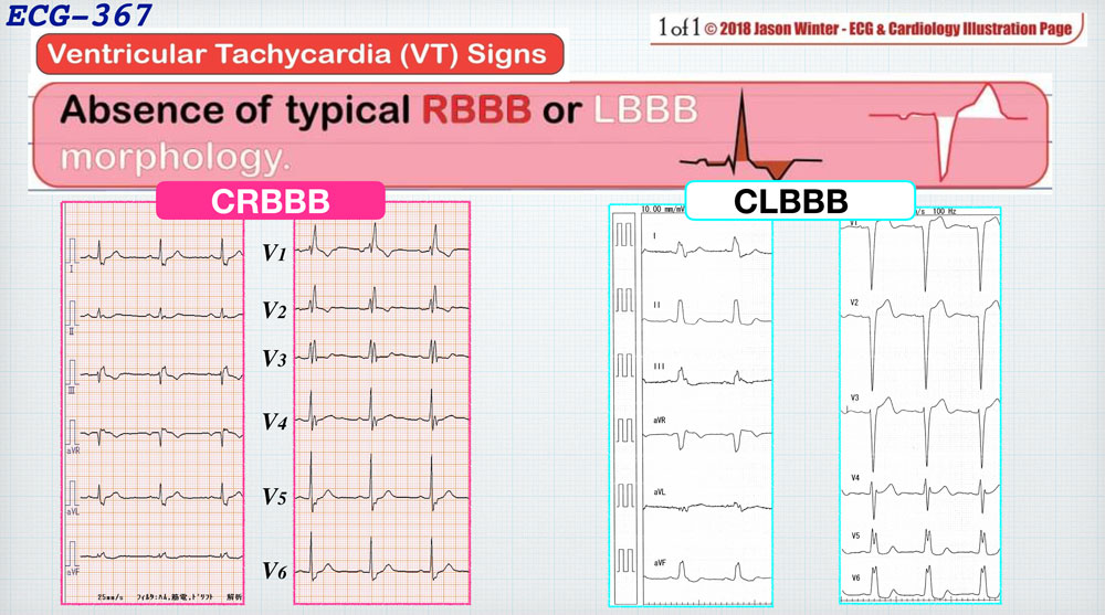 f:id:heart2019:20200312205734j:plain