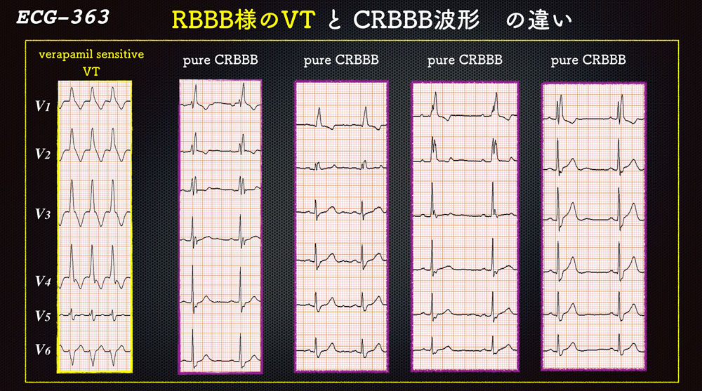 f:id:heart2019:20200312210244j:plain