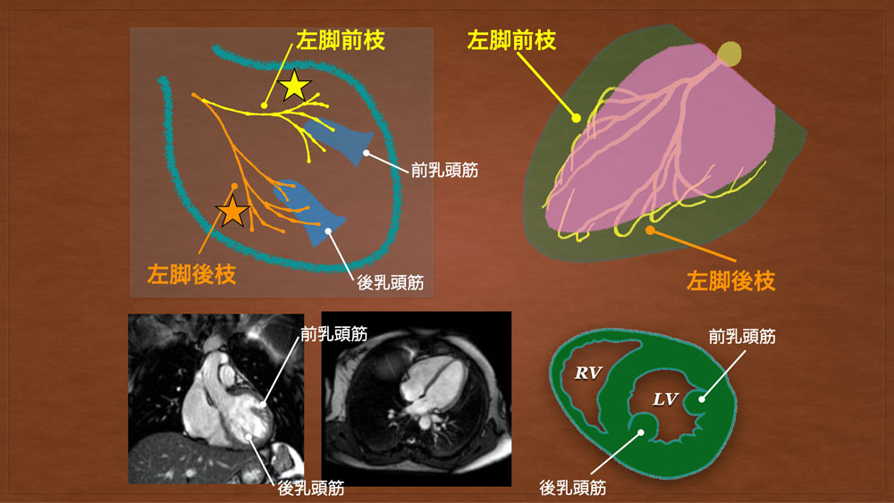 f:id:heart2019:20200506120404j:plain