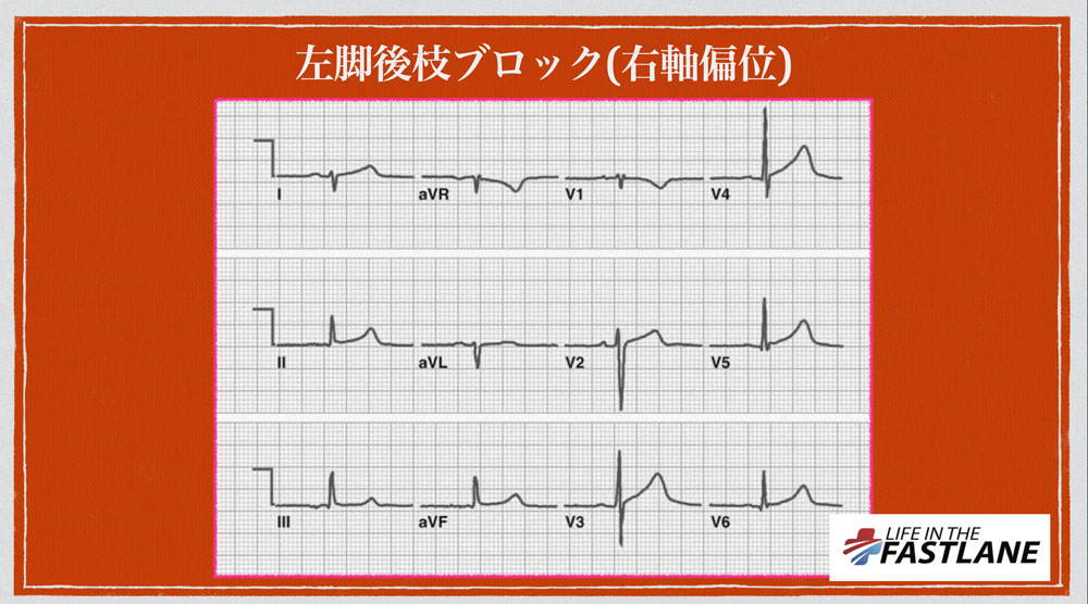 f:id:heart2019:20200506120932j:plain