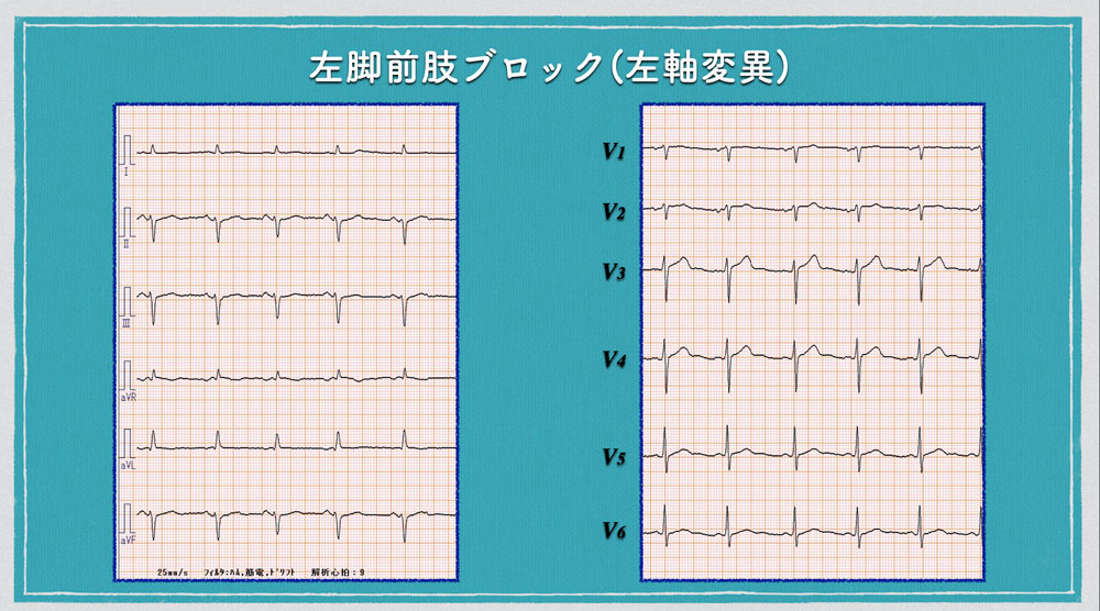 f:id:heart2019:20200506121022j:plain