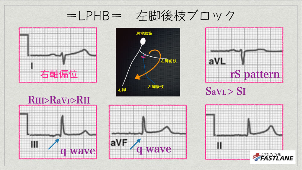 f:id:heart2019:20200506124038j:plain