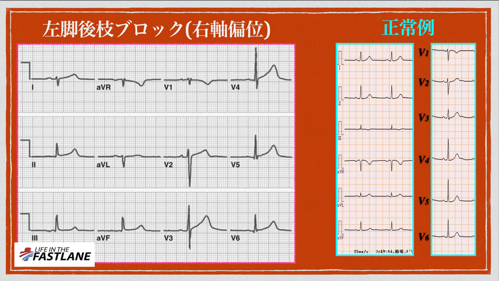 f:id:heart2019:20200506124519j:plain