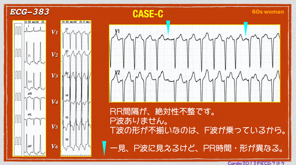 f:id:heart2019:20200603141243j:plain