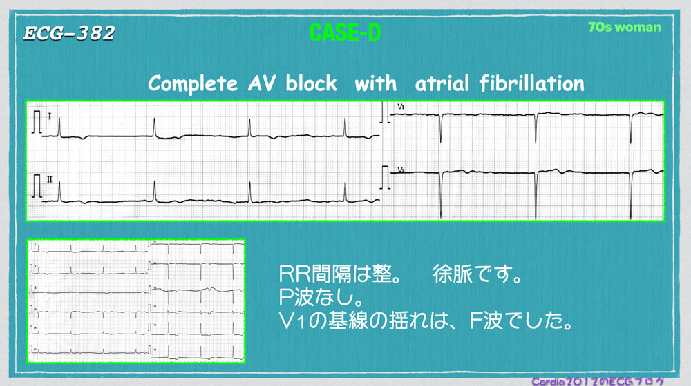 f:id:heart2019:20200603141417j:plain