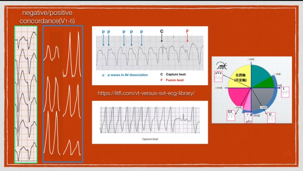 Ecg3117vtweb