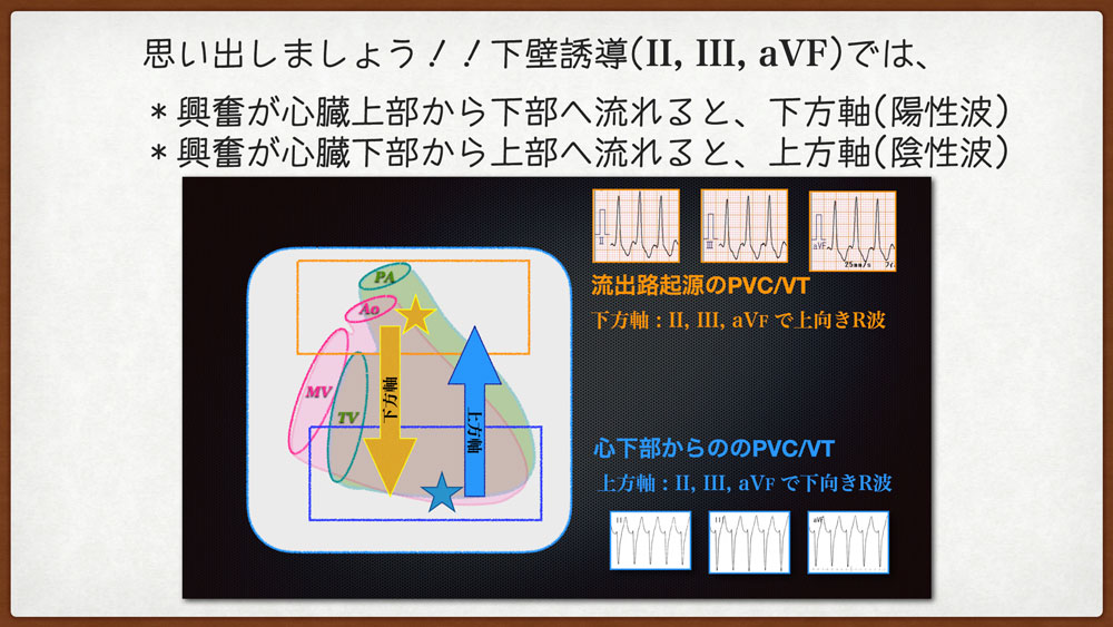 コラム-110：質問箱より (公式問題集&ガイド/実力心電図)を解説