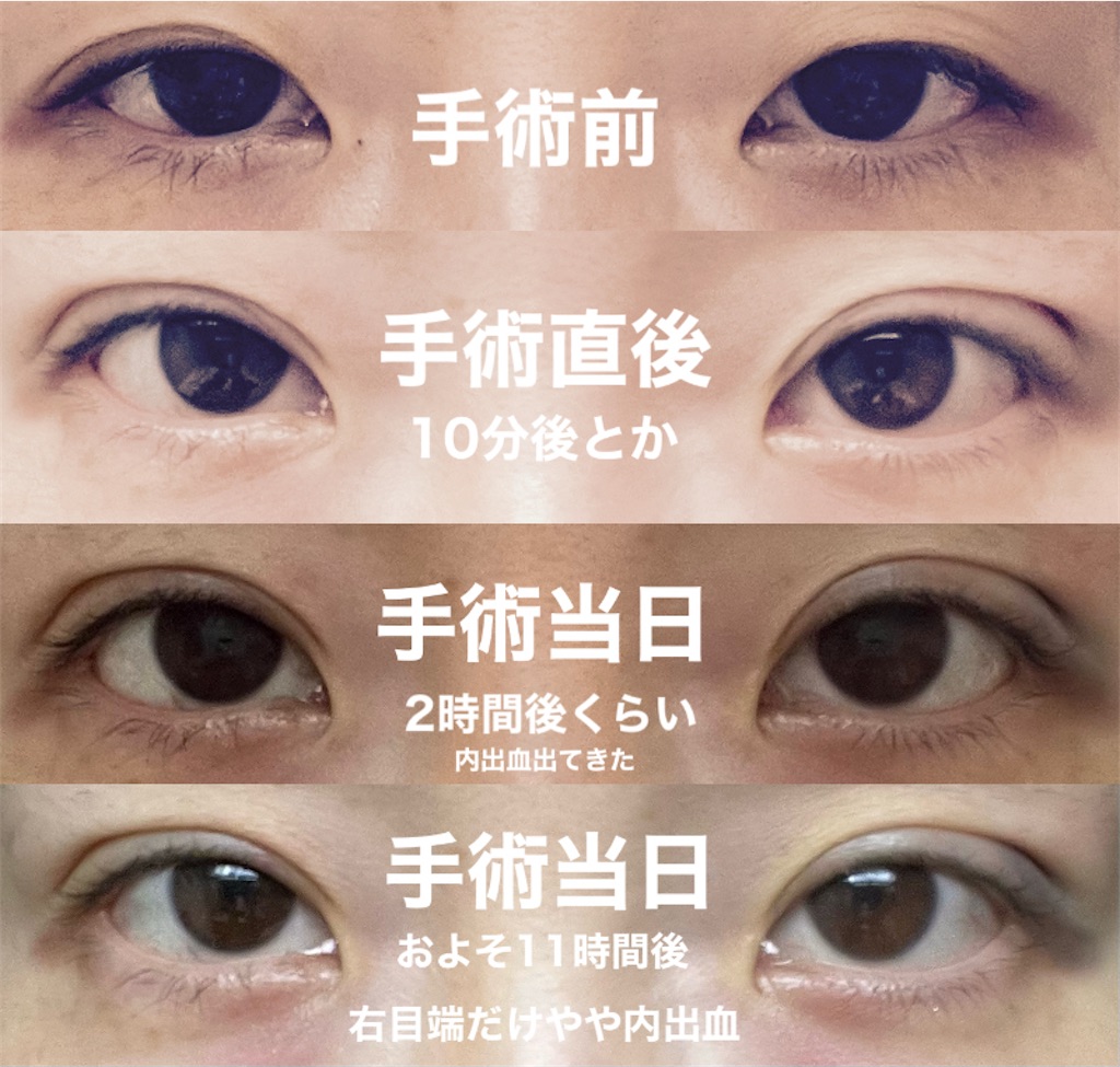 f:id:henjanaimon:20250131230528j:image f:id:henjanaimon:20250131230528j:image