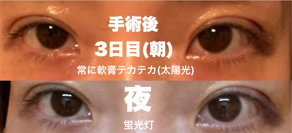 f:id:henjanaimon:20250305224352j:image f:id:henjanaimon:20250305224352j:image