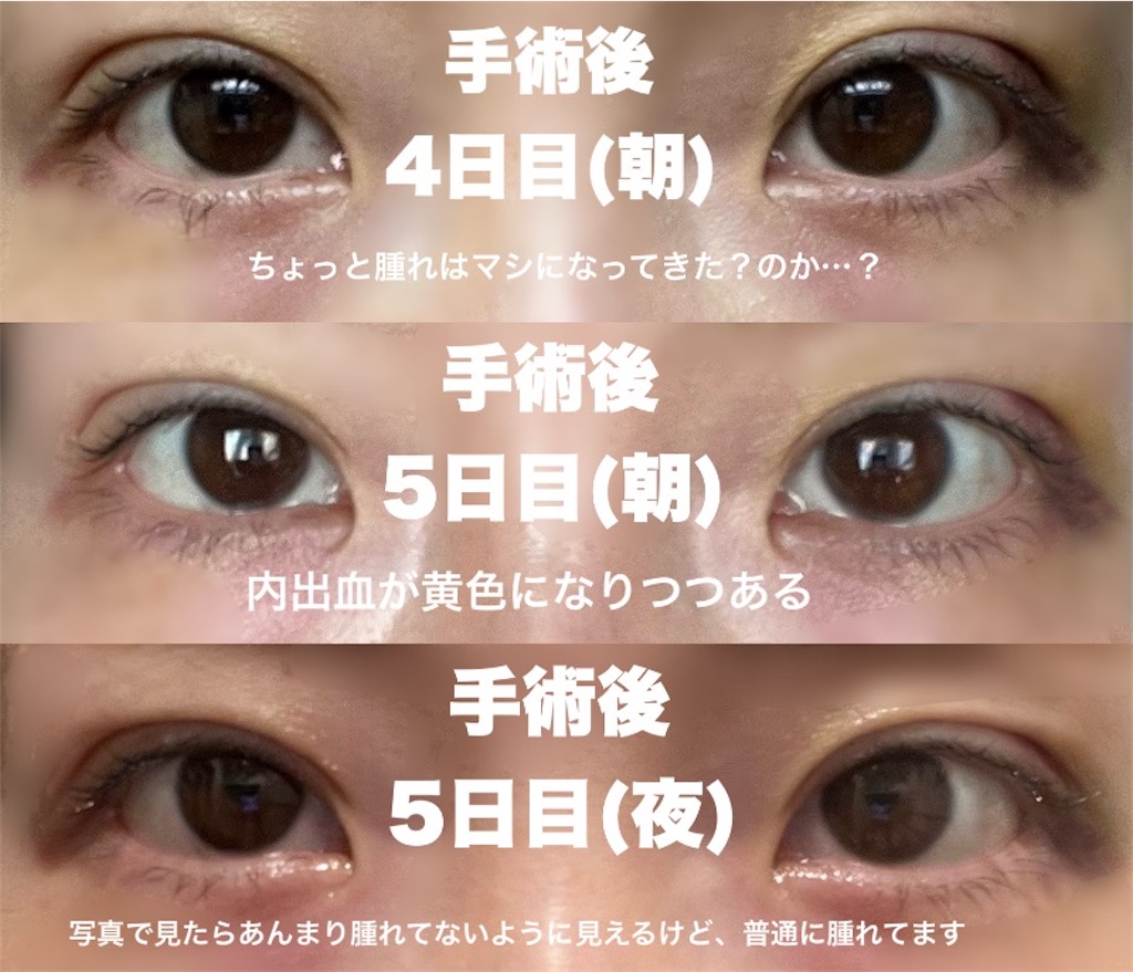 f:id:henjanaimon:20250305230137j:image f:id:henjanaimon:20250305230137j:image