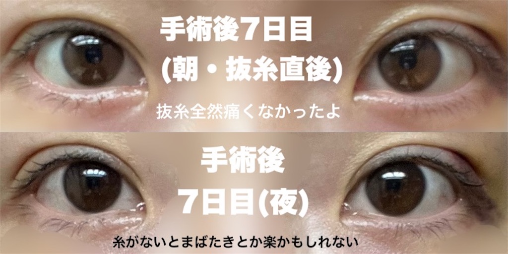 f:id:henjanaimon:20250305230343j:image f:id:henjanaimon:20250305230343j:image