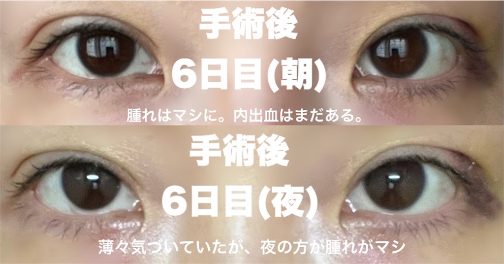 f:id:henjanaimon:20250305230346j:image f:id:henjanaimon:20250305230346j:image