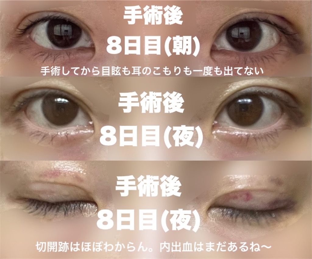 f:id:henjanaimon:20250305230349j:image f:id:henjanaimon:20250305230349j:image